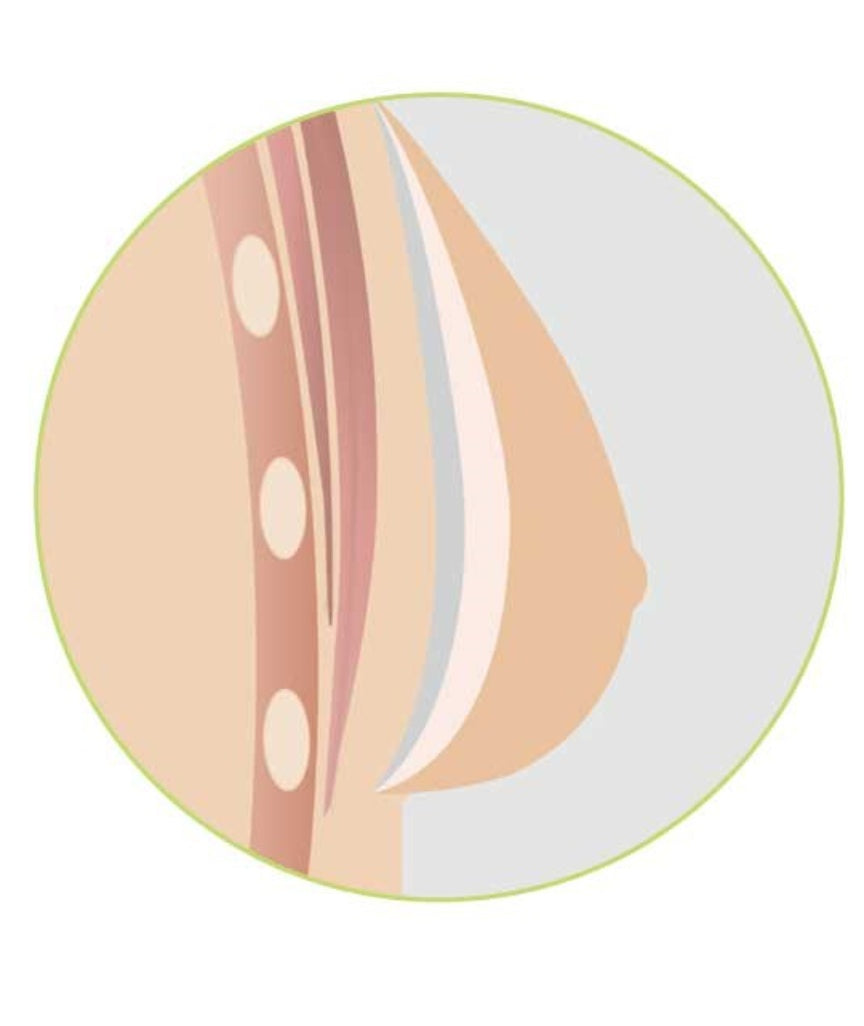 Amoena Natura Cosmetic 3E Breast Form - Ivory (Right)