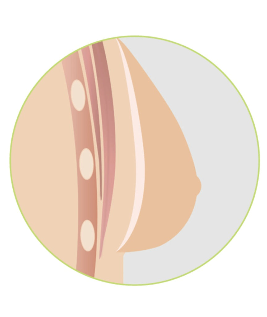Amoena Natura Xtra Light 2S Breast Form - Ivory